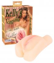 Kelly&acute;s Vagina